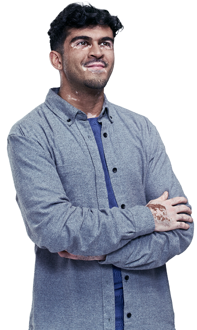 Man with vitiligo